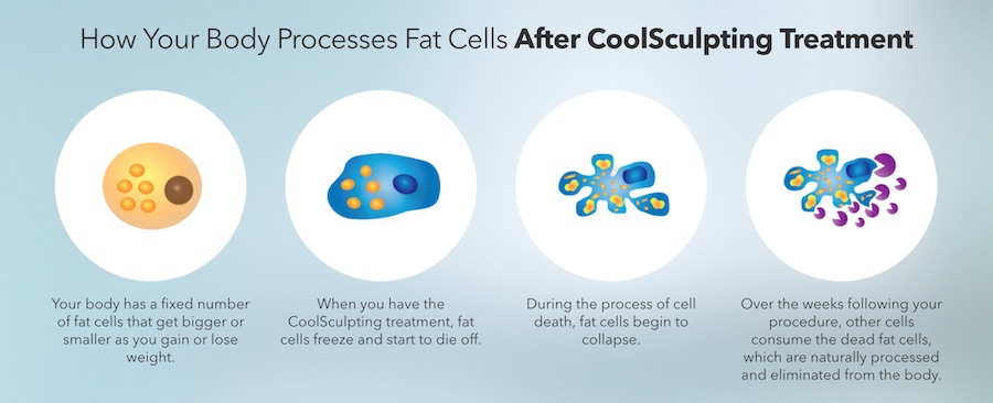 cool sculpt freeze fat cells away